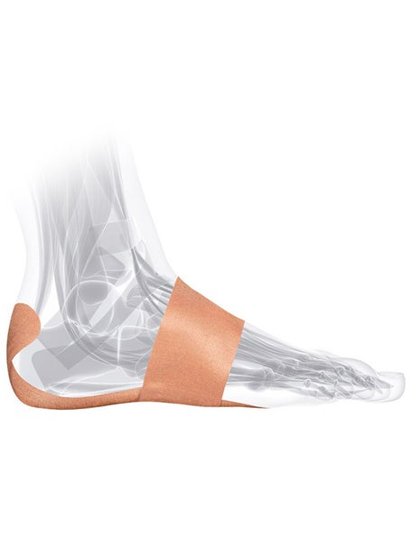 Mueller PFTape Systems - Plantar Fasciitis (7 Strips)